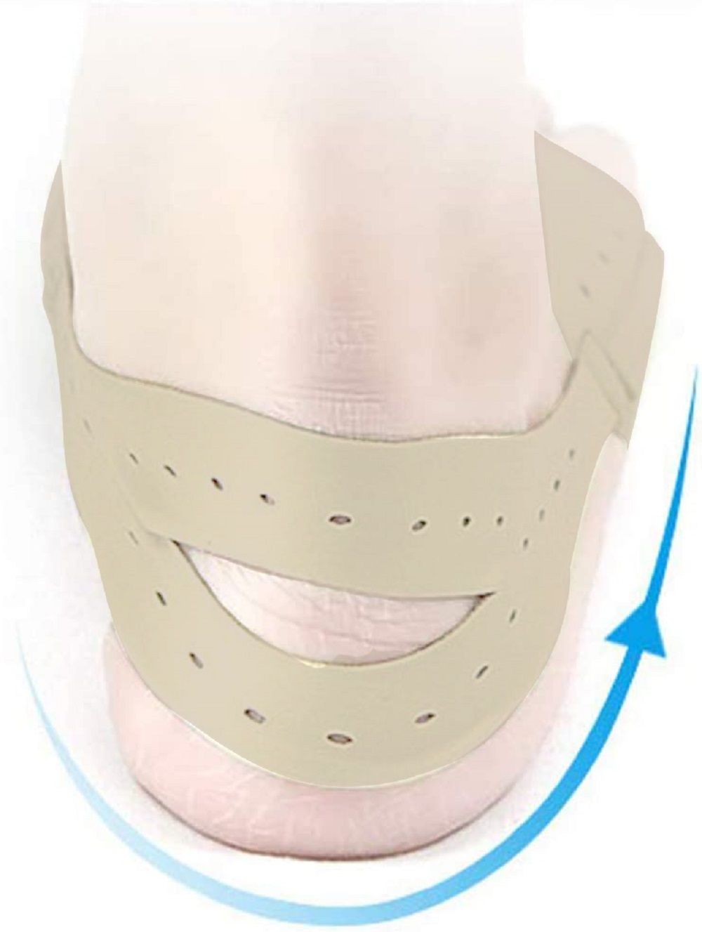 Hallux Bandage am Fuß. Beige, perforiertes Material. Bandage um den Knöchel. Blaue Pfeile zeigen die Richtung.