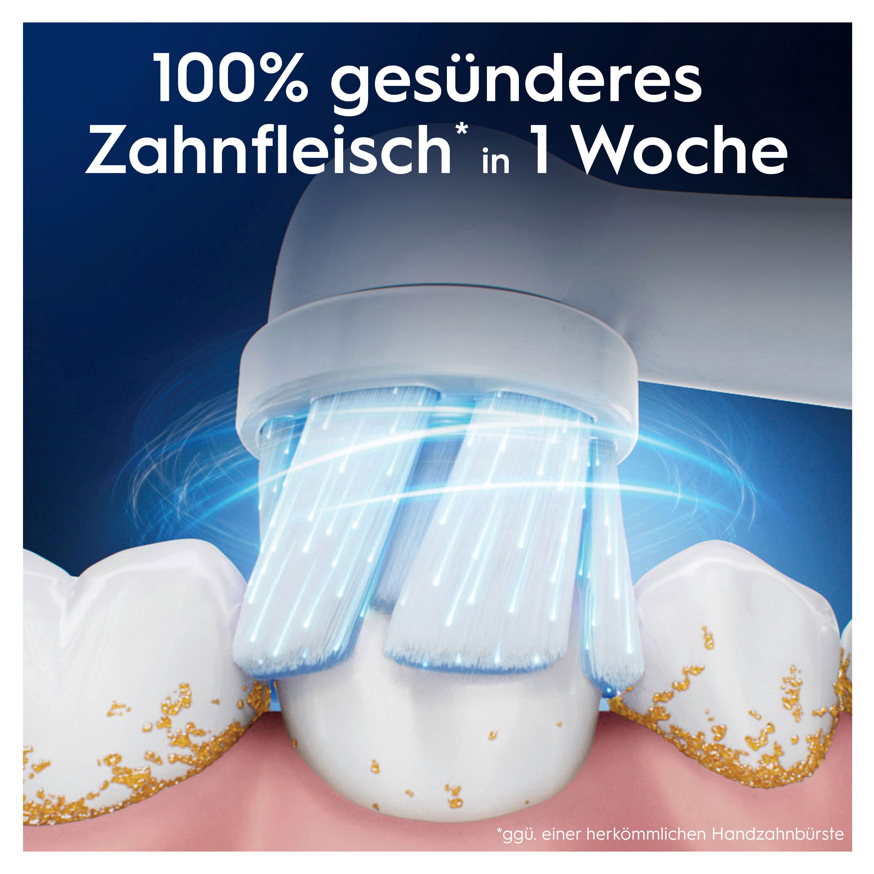 Nahaufnahme einer Zahnbürste, die Zähne putzt. Text: 100% gesünderes Zahnfleisch in 1 Woche.