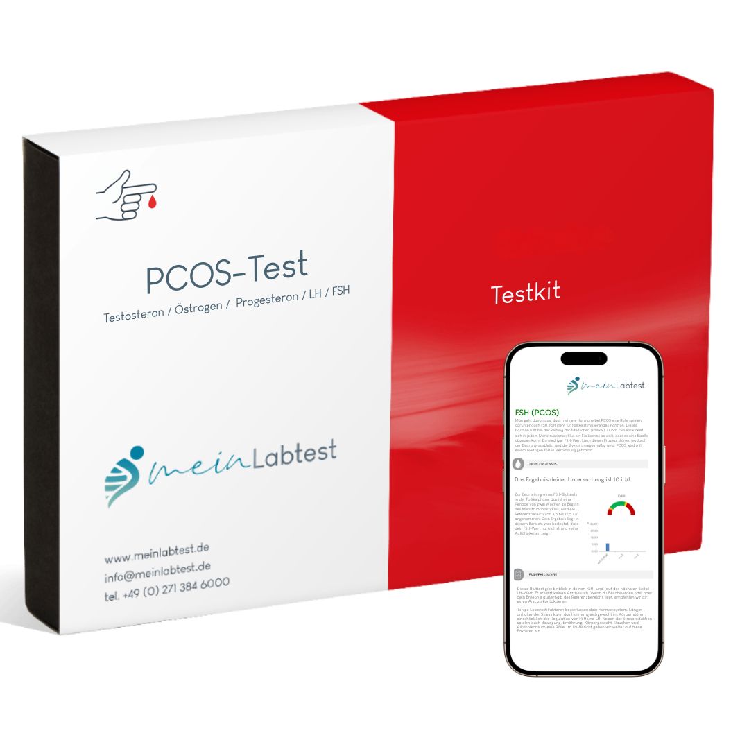 PCOS-Test-Kit. Weiß-roter Karton mit Produktinformationen und Smartphone mit Testergebnissen.