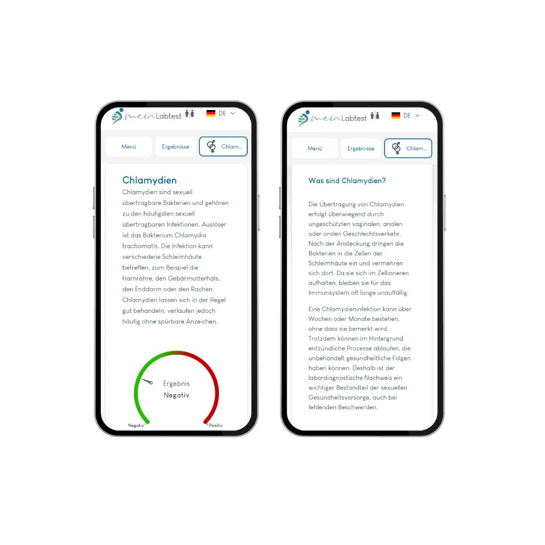 Meinlabtest Chlamydien-Test Männer (Urin)
