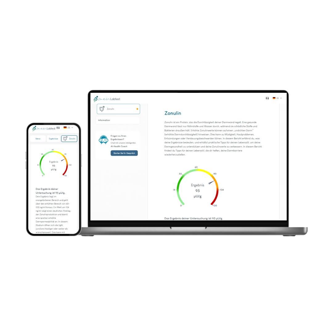 Laptop und Smartphone mit Testergebnissen. Auf dem Laptop: Zonulin-Informationen und Ergebnis-Diagramm. Auf dem Smartphone: Ergebnis-Diagramm.