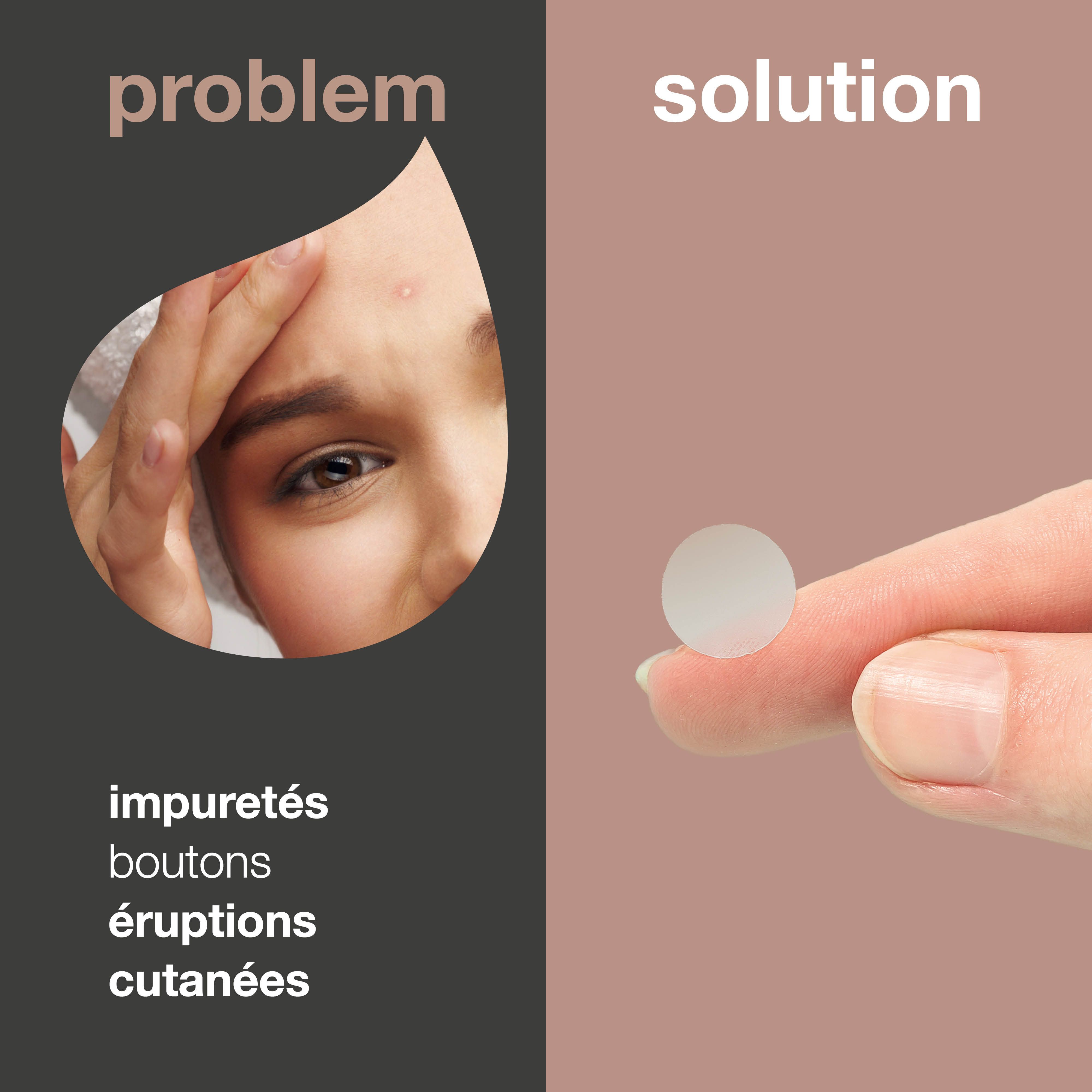 Image en deux parties : problème et solution. Patch anti-boutons sur un doigt. Texte : impuretés, boutons.