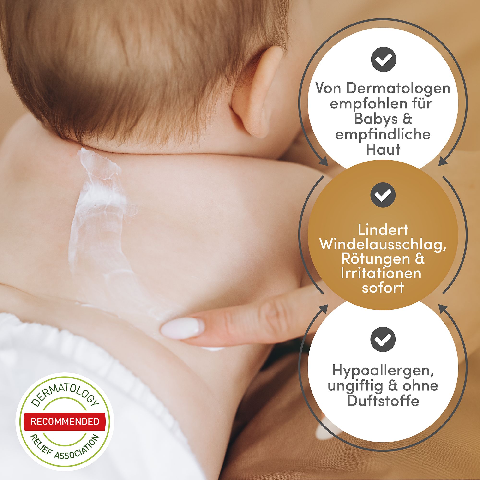 Baby mit Creme auf dem Hals. Text: Von Dermatologen empfohlen, Lindert Windelausschlag, Hypoallergen, ohne Duftstoffe.