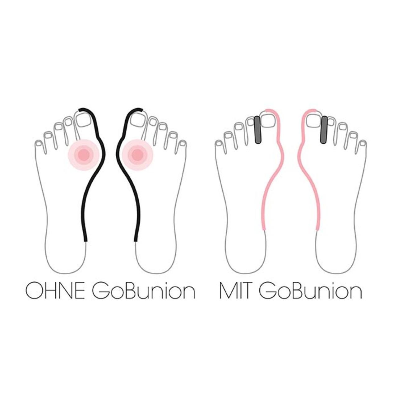 GoBunion, GoBunion Füßlinge mit Zehenspreizer 39-42 schwarz