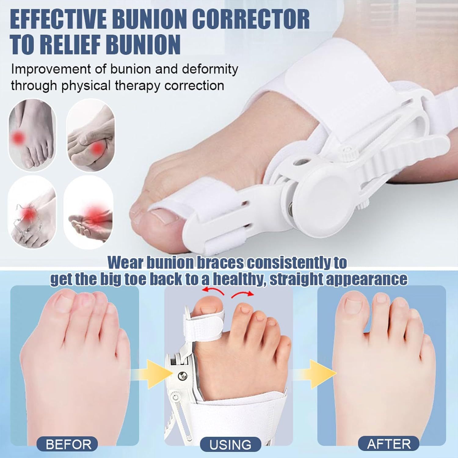 COOL-i Hallux valgus Korrektor mit Drehverstellung, links/rechts tragbar & individuell einstellbar