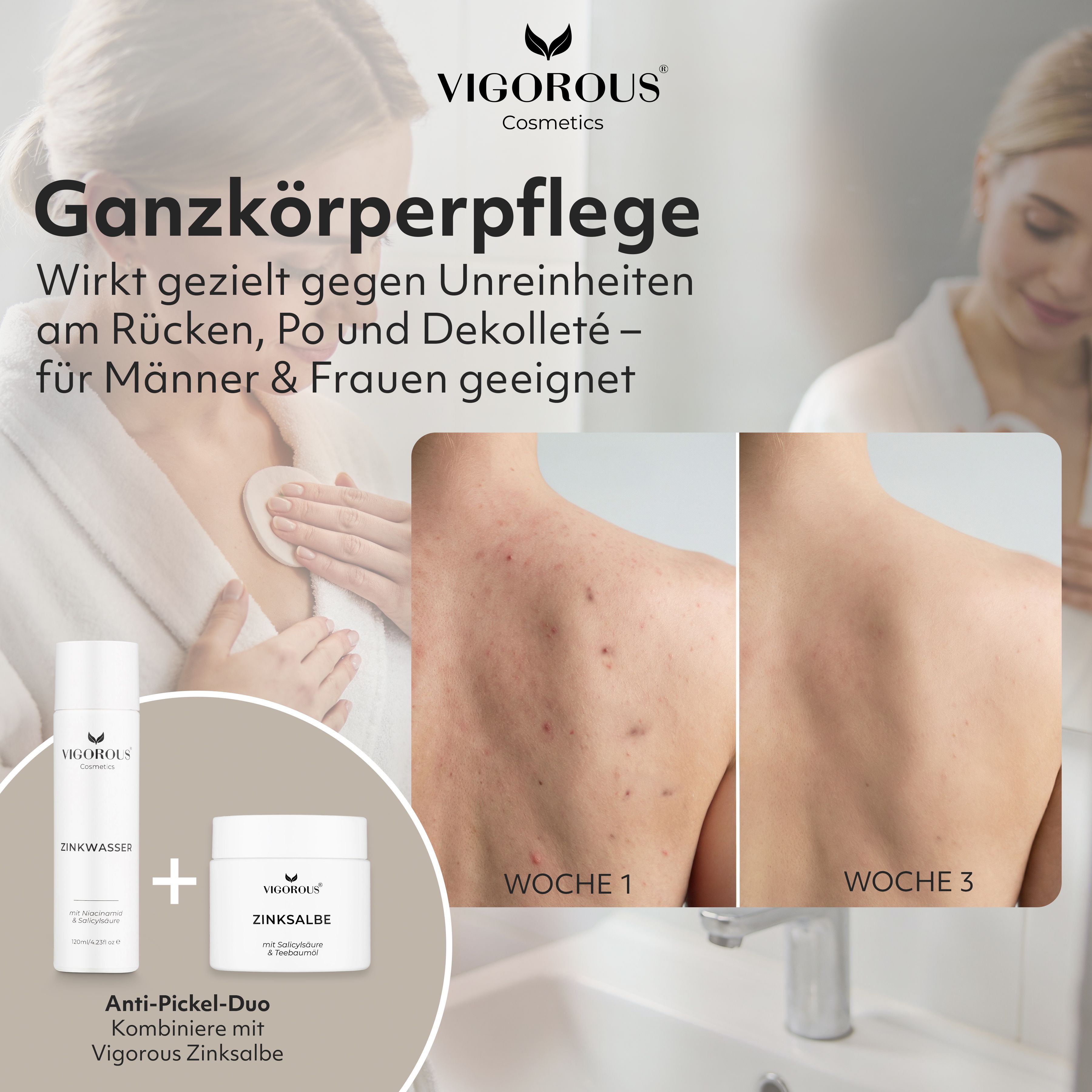 Zinkwasser und Zinksalbe, Rückenansichten. Text: Ganzkörperpflege. Anti-Pickel-Duo. VIGOROUS® Cosmetics.