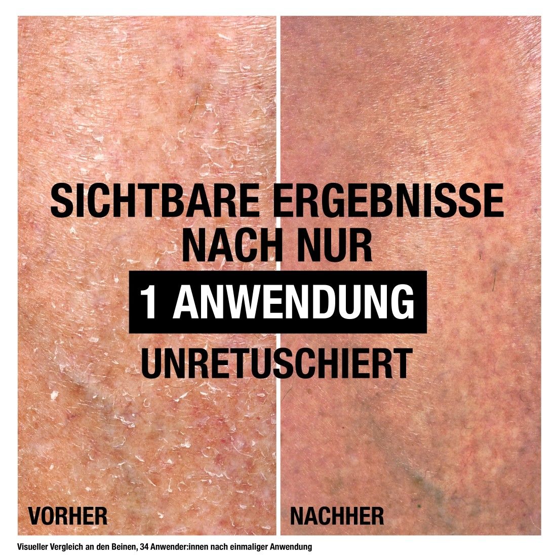 Vorher-Nachher-Vergleich von Haut. Text: Sichtbare Ergebnisse nach 1 Anwendung. Unretuschiert.