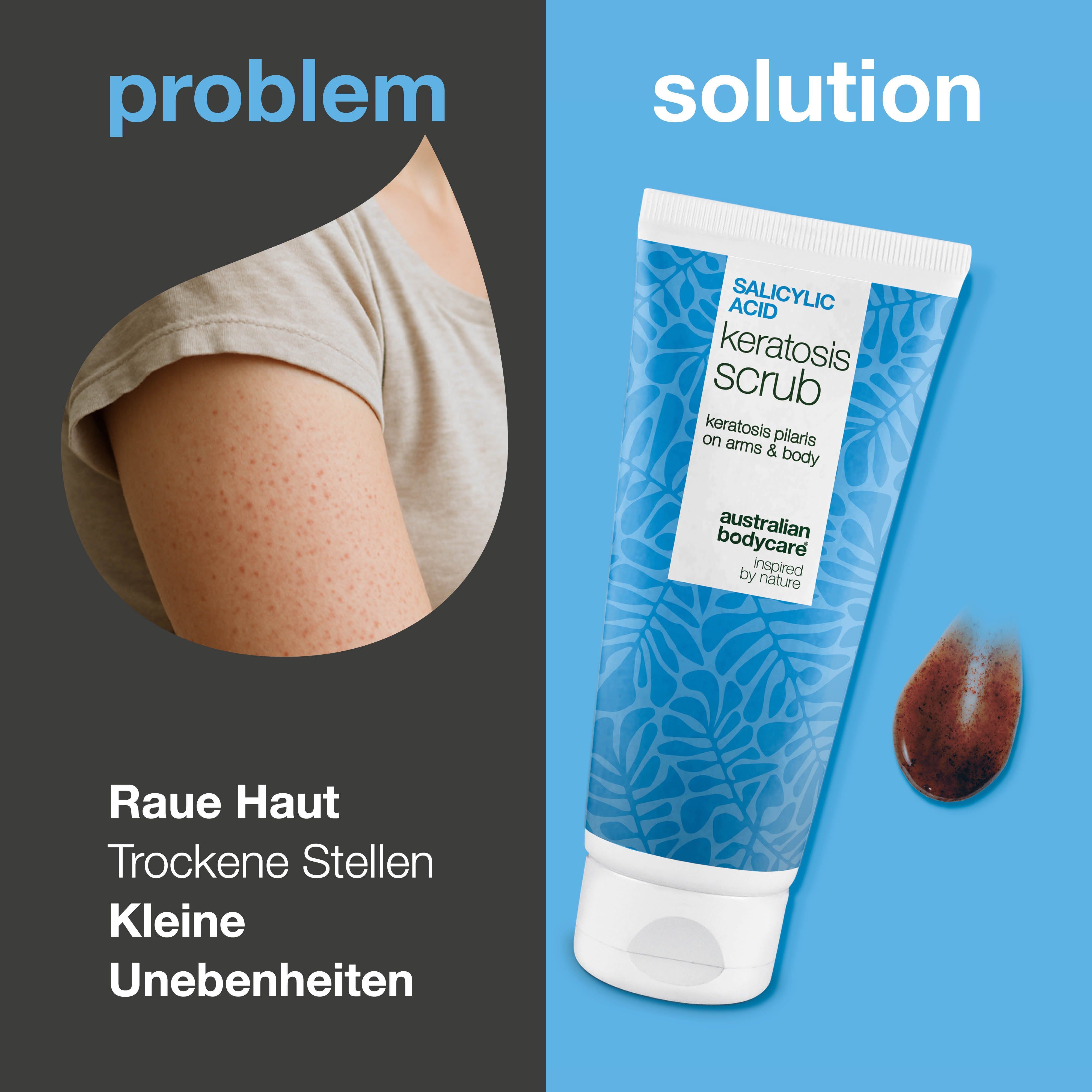 Produkt-Tube und Hautausschnitt mit rauer Haut. Text: Salicylsäure Keratosis Scrub. Marke: Australian Bodycare.