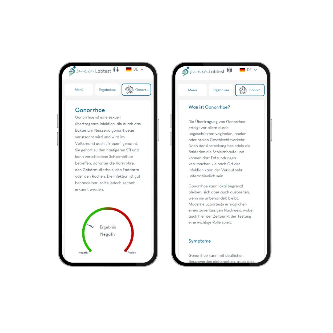 Meinlabtest Tripper-Test Männer (Urin)