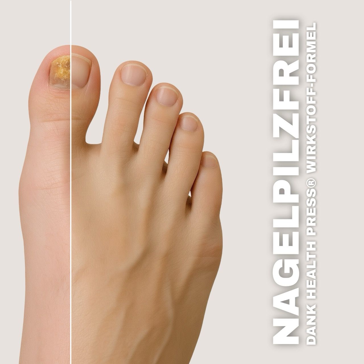 Health Press Nagelpilz Stift Angebot