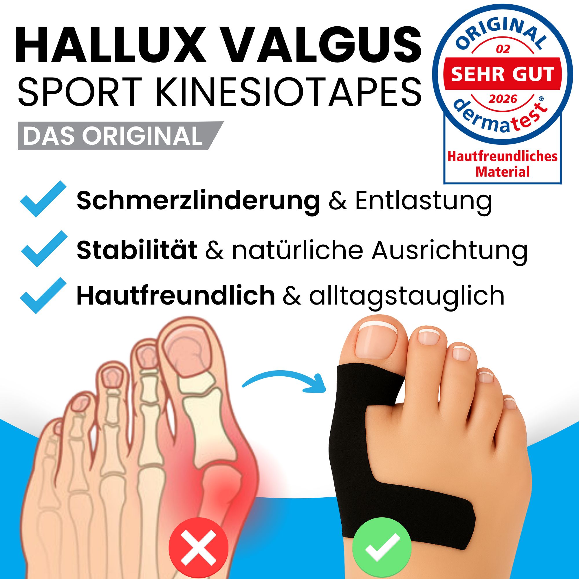 Hallux Valgus Sport Kinesiologisches Tape: Schema des Fußes und Anwendung am Zeh.