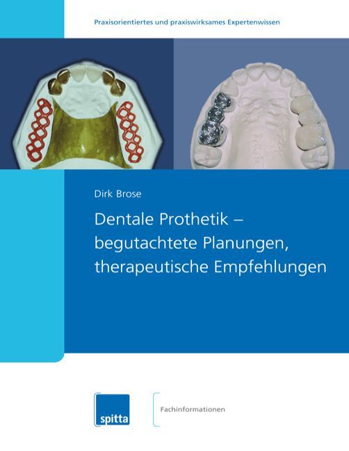 Buchcover mit dem Titel "Dentale Prothetik". Abgebildet sind Zahnmodelle mit Prothesen. Autor: Dirk Brose. Verlag: Spitta.