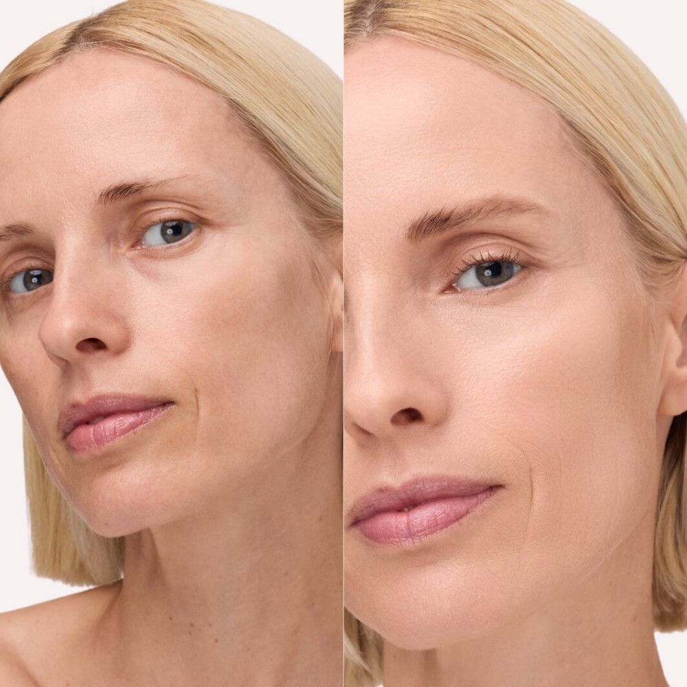 Vorher-Nachher-Vergleich. Frau mit ungeschminktem Gesicht und Gesicht mit Make-up. Haut wirkt ebenmäßiger.