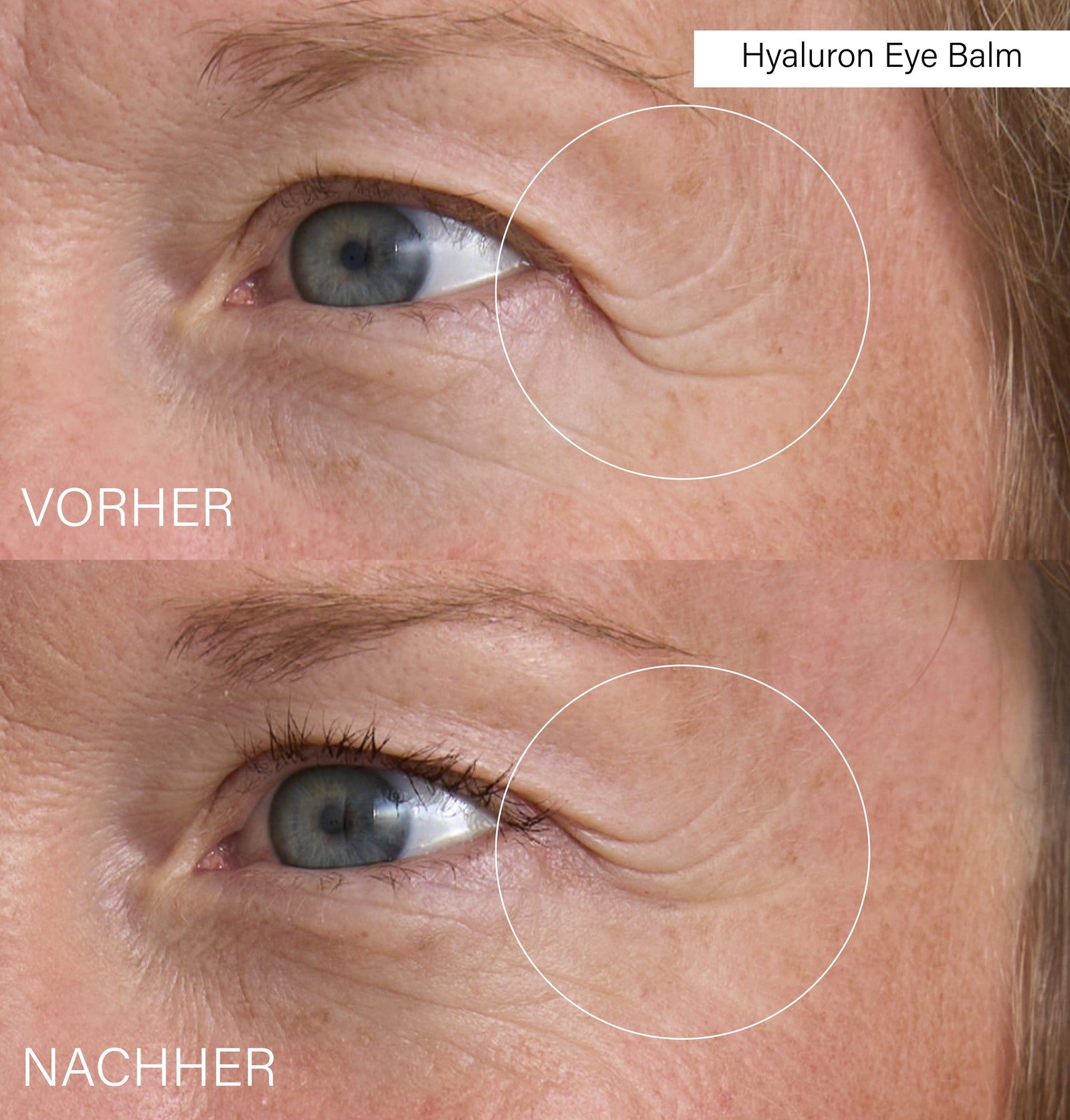 Rosental Organics Hyaluron Eye Balm