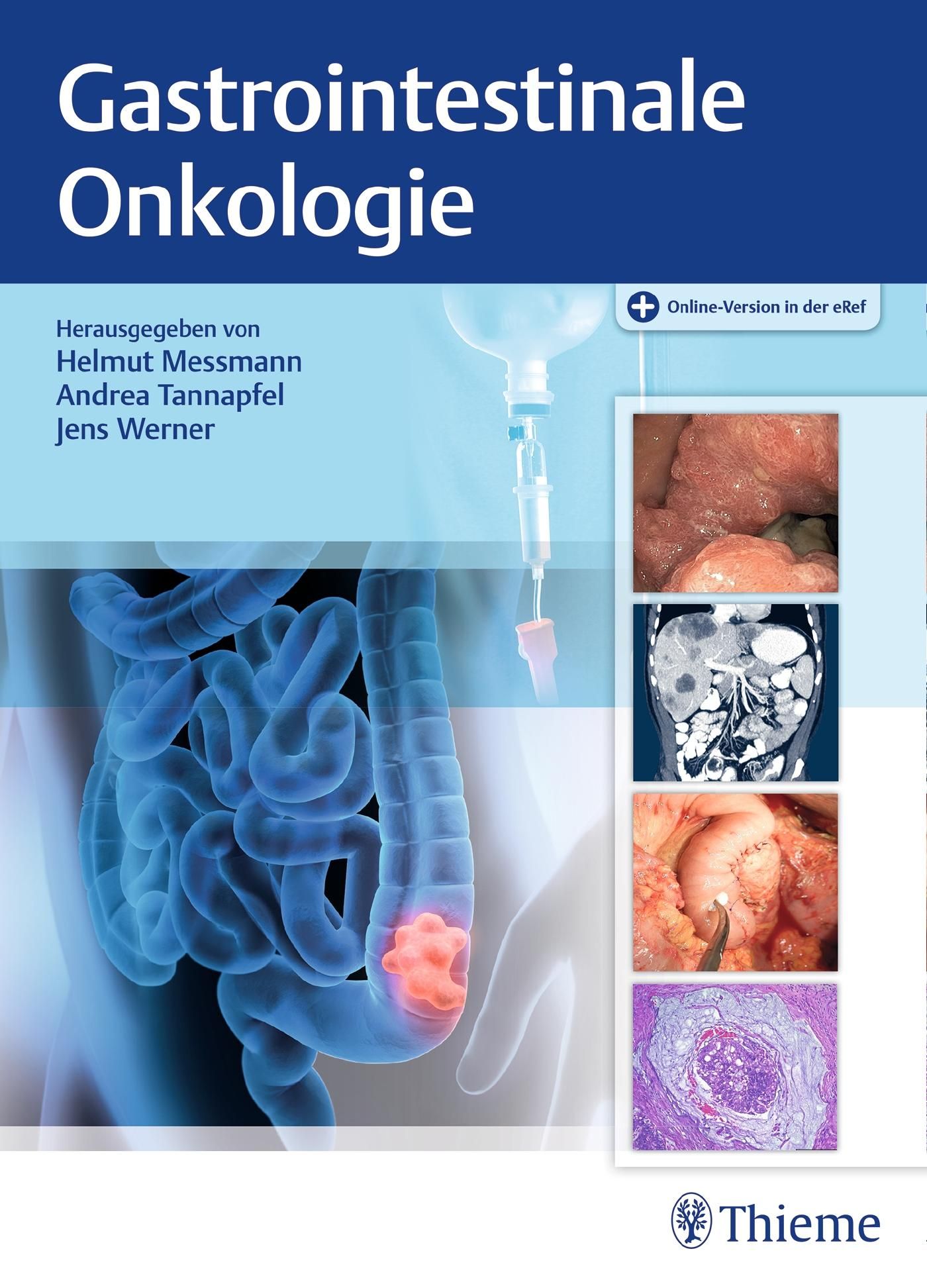 Gastrointestinale Onkologie Plus Online-Version in der eRef