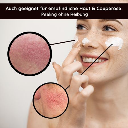 RAU Cosmetics Fruit Acid AHA, 2% BHA, PHA Fruchtsäurepeeling inkl. Neutralizer gegen Mitesser, Akne