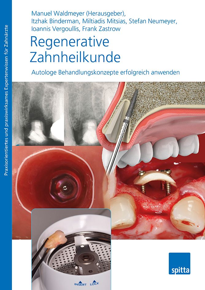 Buchcover mit dem Titel "Regenerative Zahnheilkunde". Illustrationen von Zähnen und zahnmedizinischen Instrumenten. Spitta-Logo.