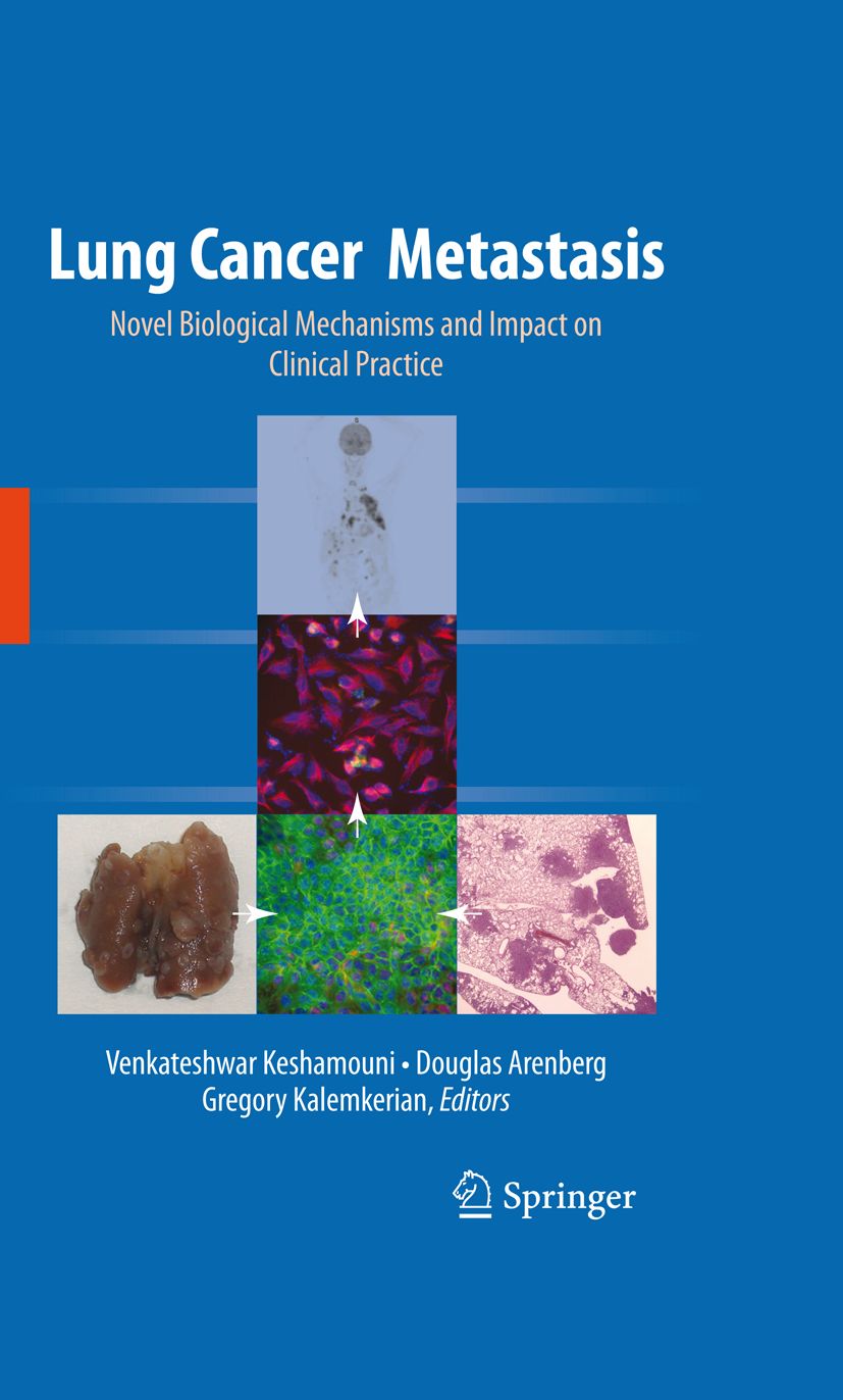 Buchcover: Lung Cancer Metastasis. Titel, Autoren und Springer-Logo. Abbildungen von biologischen Mechanismen.