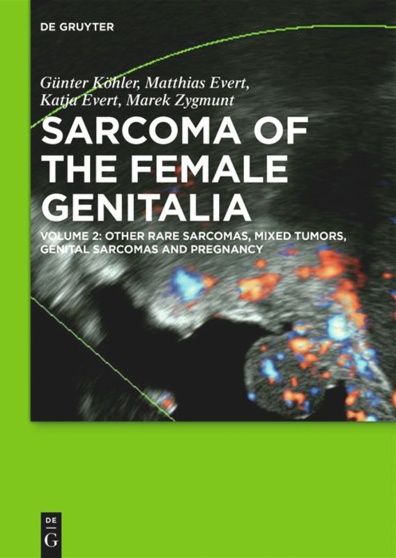 Sarcoma of the Female Genitalia Other Rare Sarcomas, Mixed Tumors, Genital Sarcomas and Pregnancy