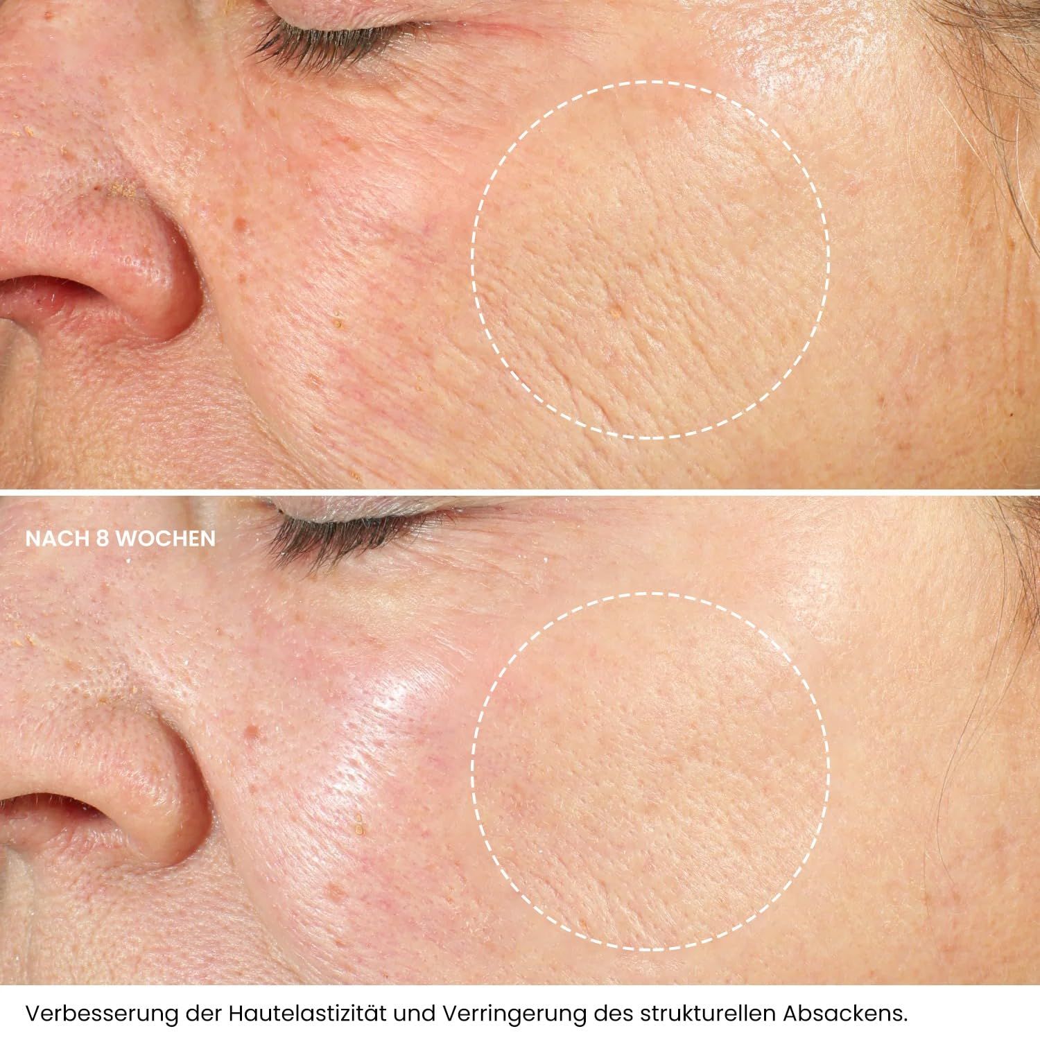 Kleem Anti-Aging Retinol Nachtcreme