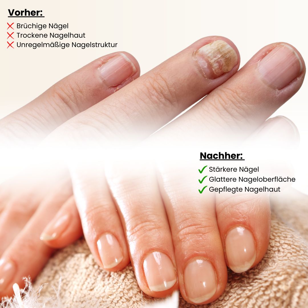 Vorher-Nachher-Vergleich. Links: brüchige Nägel. Rechts: stärkere Nägel, glattere Oberfläche, gepflegte Nagelhaut.
