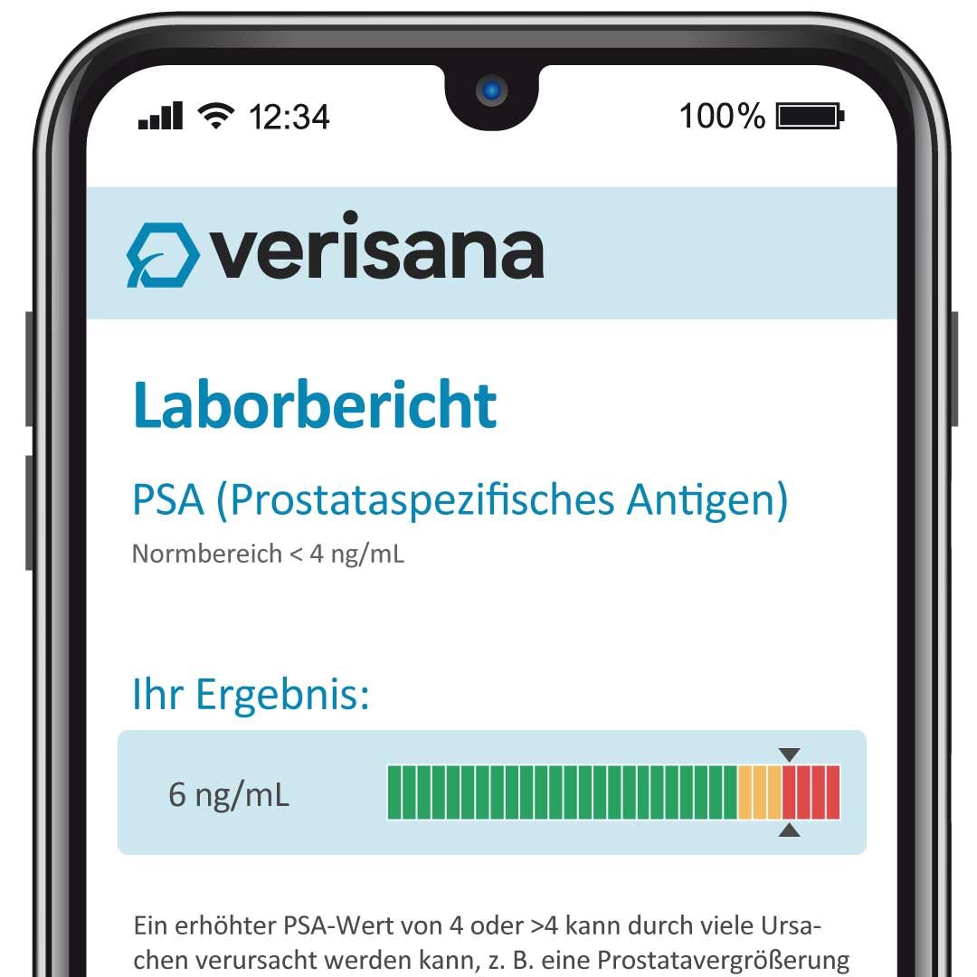 Smartphone mit Verisana-App. Anzeige des Laborberichts PSA. Ergebnisse mit farbiger Balkendarstellung.