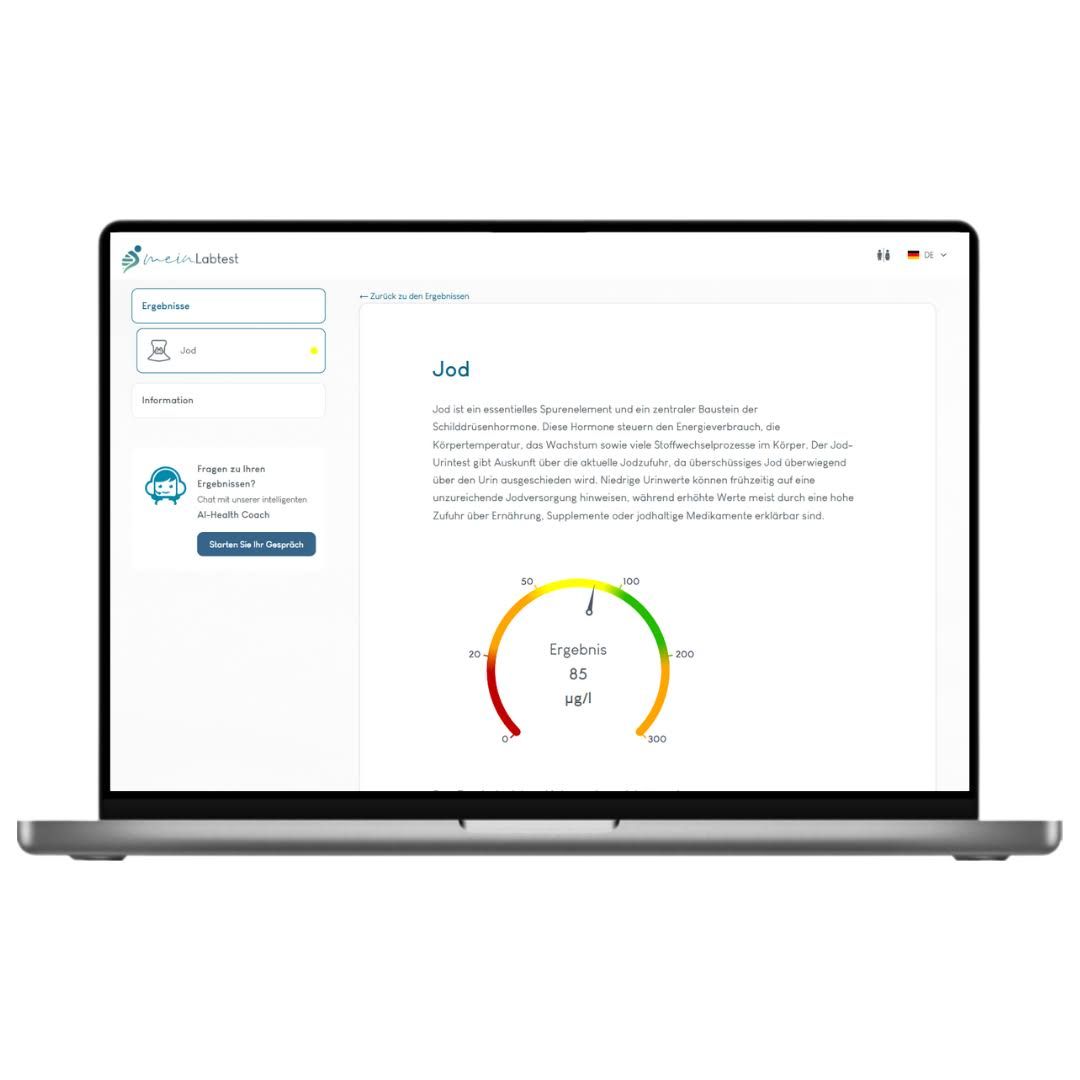 Laptop zeigt Testergebnis. Text über Jod. Kreisdiagramm mit Ergebnis. Logo meinlabtest.