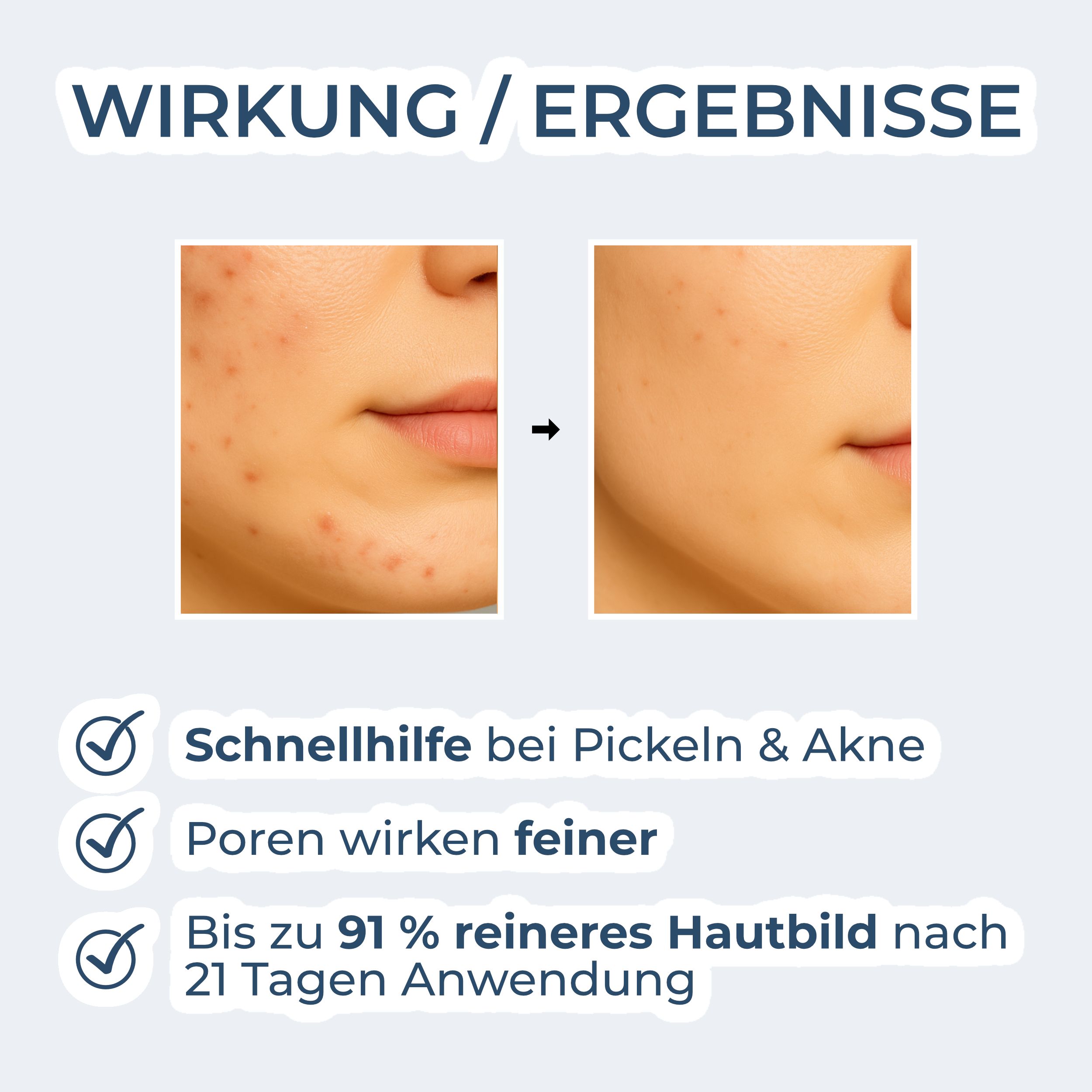 VIGOROUS® Zinkwasser – klärt Poren tiefenrein, bekämpft unreine Haut & Pickel