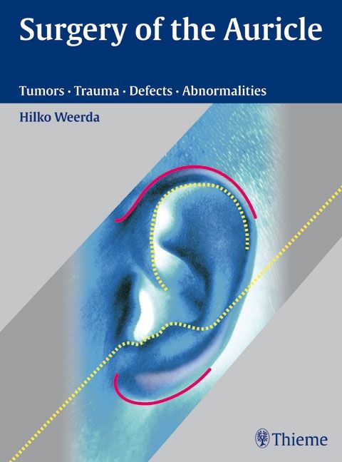 Buchcover: Surgery of the Auricle. Titel, Autorenname und Illustration eines Ohrs mit Markierungen. Verlag Thieme.