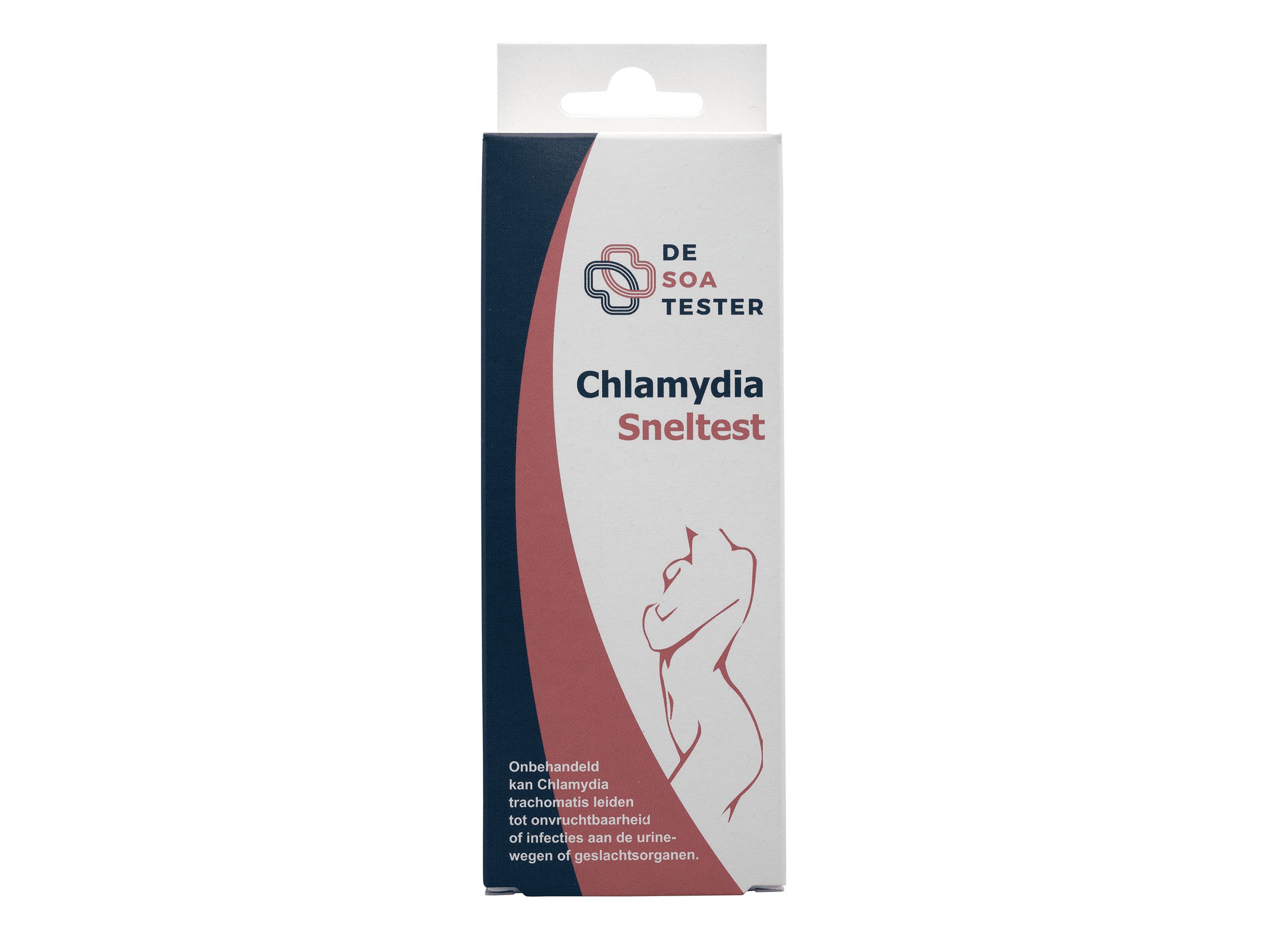 Test clamidia donna