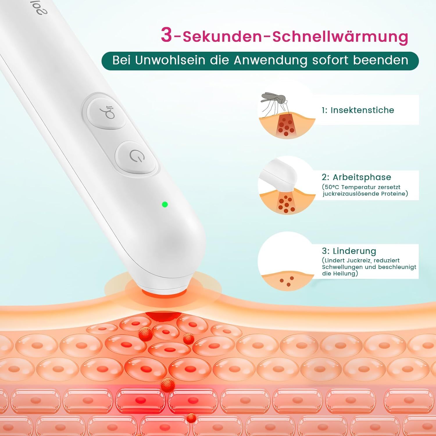 Solveitek Mückenstich Hitzestift, Insektenstichheiler für die Schnelle Behandlung