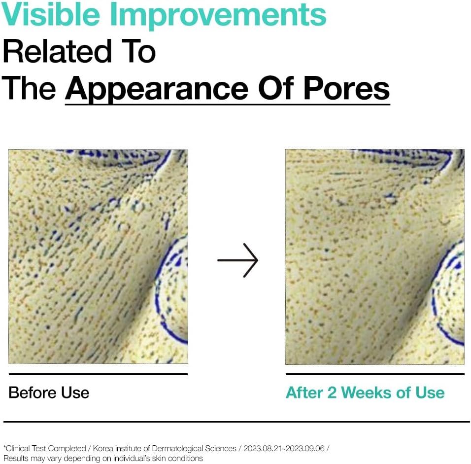 Vorher-Nachher-Vergleich von Hautporen. Links: raue Haut. Rechts: glattere Haut. Text: After 2 Weeks of Use.