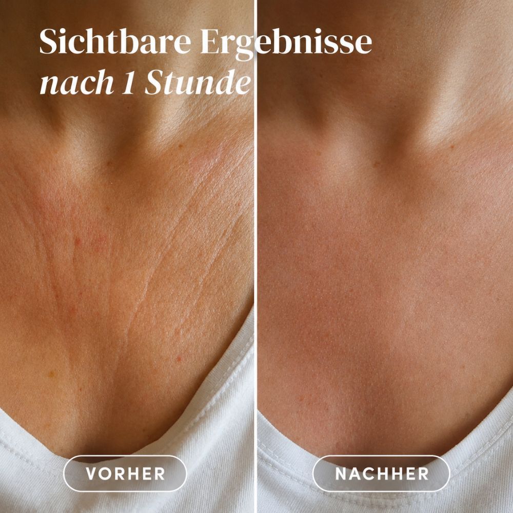 APRICOT Dekolleté Pflege-Set – Hyaluron Silikonpad + Silikonpad-Reiniger