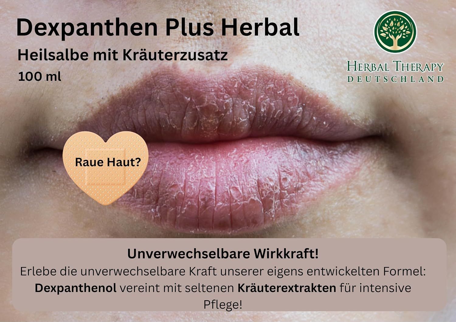Nahaufnahme trockener Lippen mit einem Herz-Patch, der die Frage 'Rauhe Haut?' stellt.
