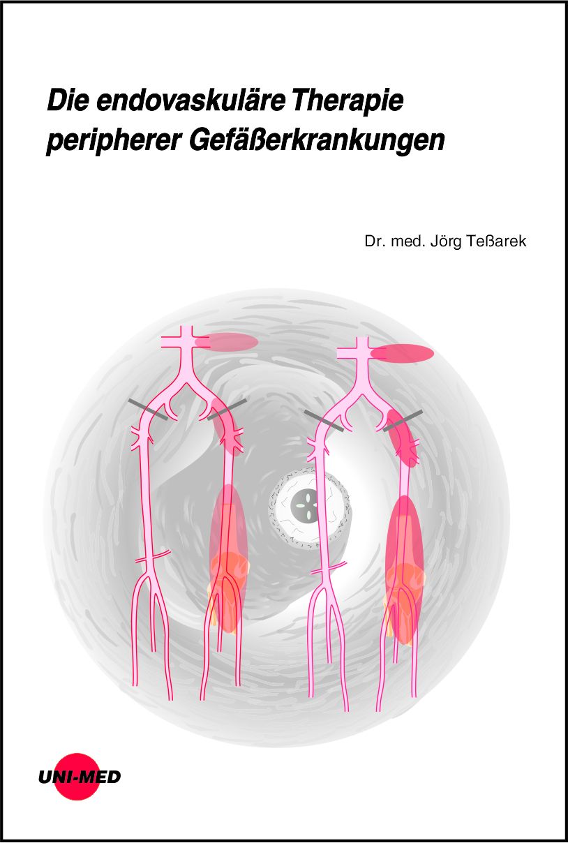 Buchcover mit Titel: Die endovaskuläre Therapie peripherer Gefäßerkrankungen. Illustration von Gefäßen. UNI-MED Logo.