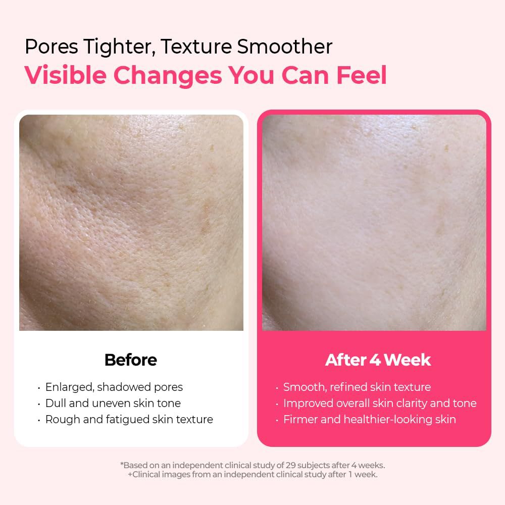 Vorher-Nachher-Vergleich von Haut. Text: Poren enger, Textur glatter. Sichtbare Veränderungen.