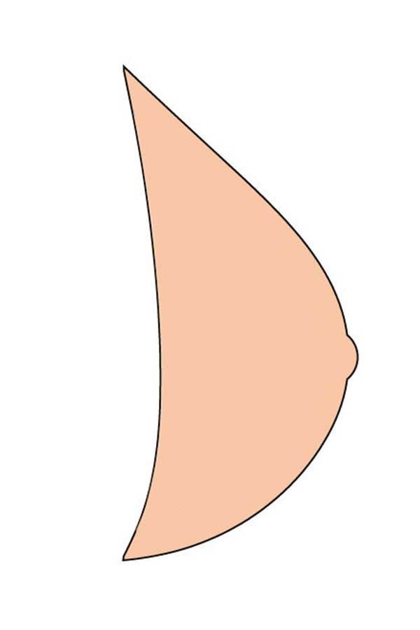 Illustration einer Brustprothese in Tropfenform, seitliche Ansicht, haut farben.