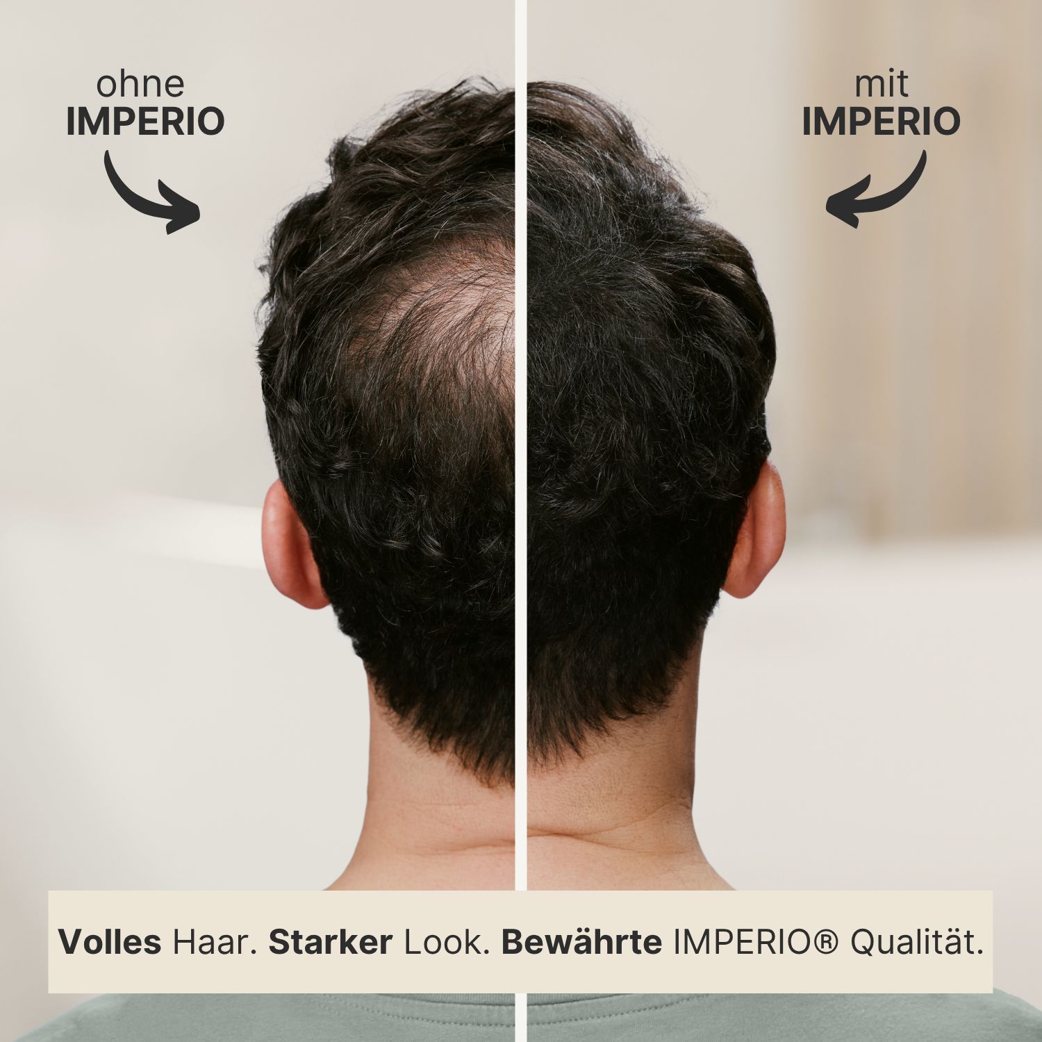 Vorher-Nachher-Vergleich. Kopf mit und ohne IMPERIO®. Text: Volles Haar. Starker Look. Bewährte IMPERIO® Qualität.