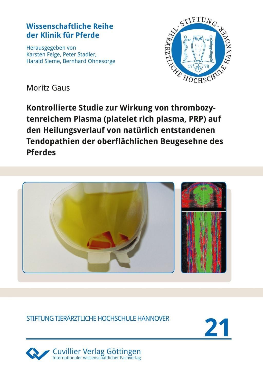 Kontrollierte Studie zur Wirkung von thrombozytenreichem Plasma (platelet rich plasma, PRP) auf d...