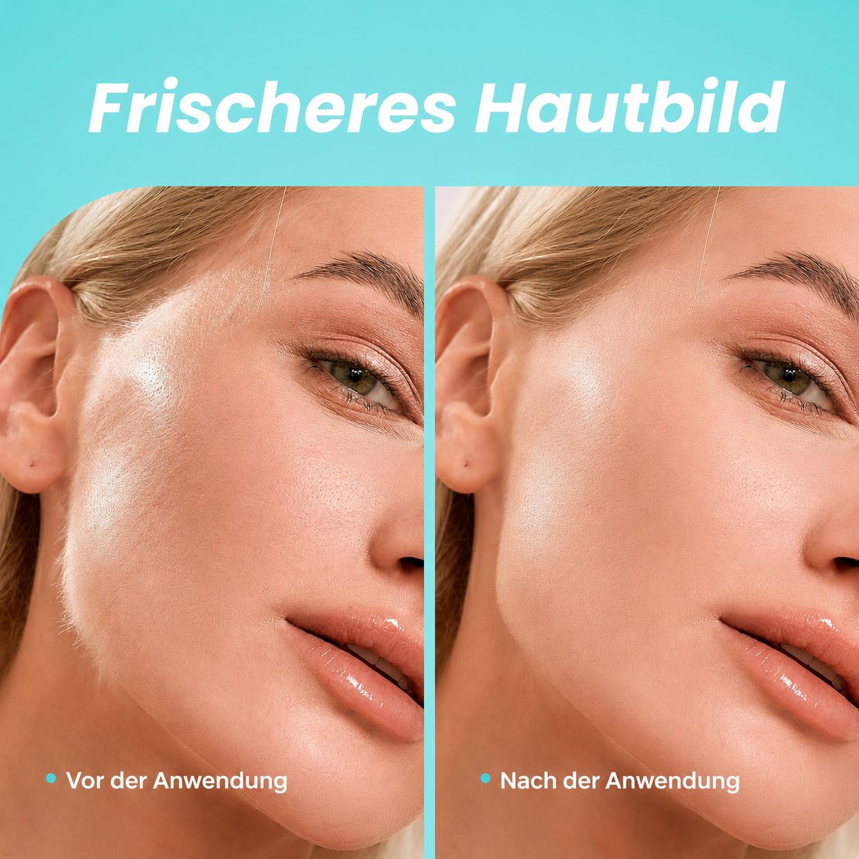 COOL-i Dermaplaning Gerät mit LED, 3 Stufen, inkl. 6 Klingen, für Gesichtspflege