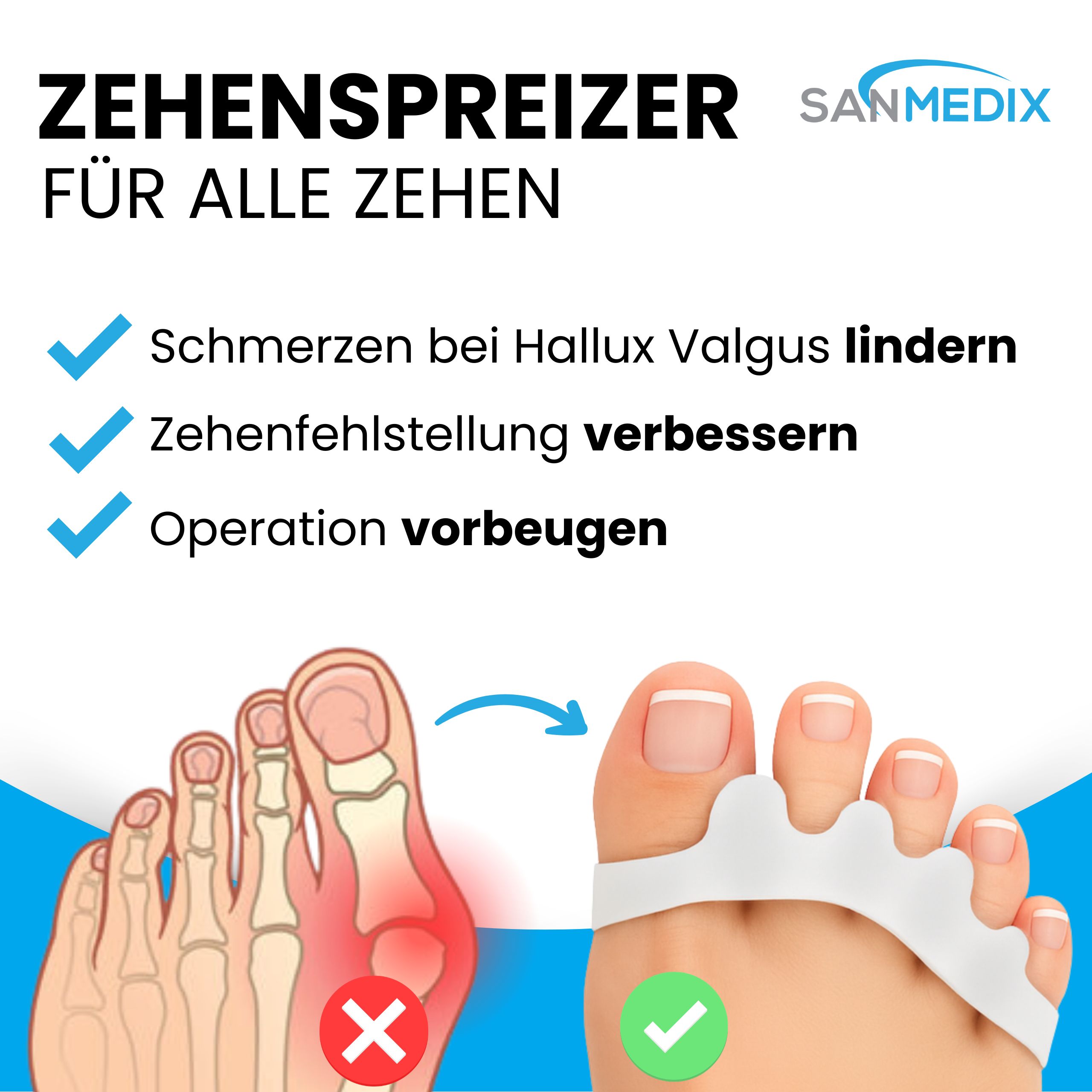 Illustrationen von Hallux Valgus Korrektur und ein Fuß mit Zehentrenner. Text: Schmerzen lindern, Fehlstellung verbessern, Operation vorbeugen.