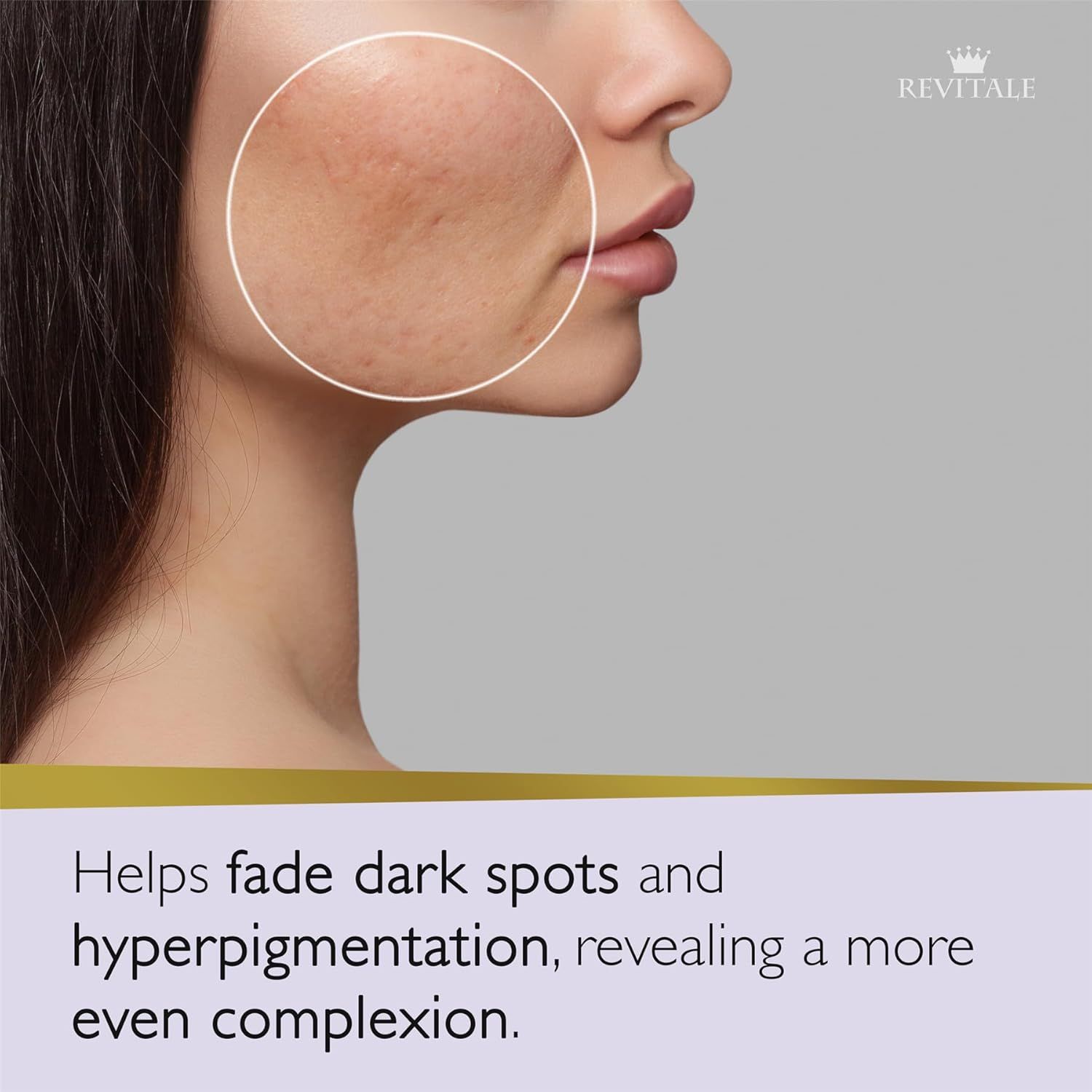 Revitale Advanced Azelainsäure und Niacinamid Seife