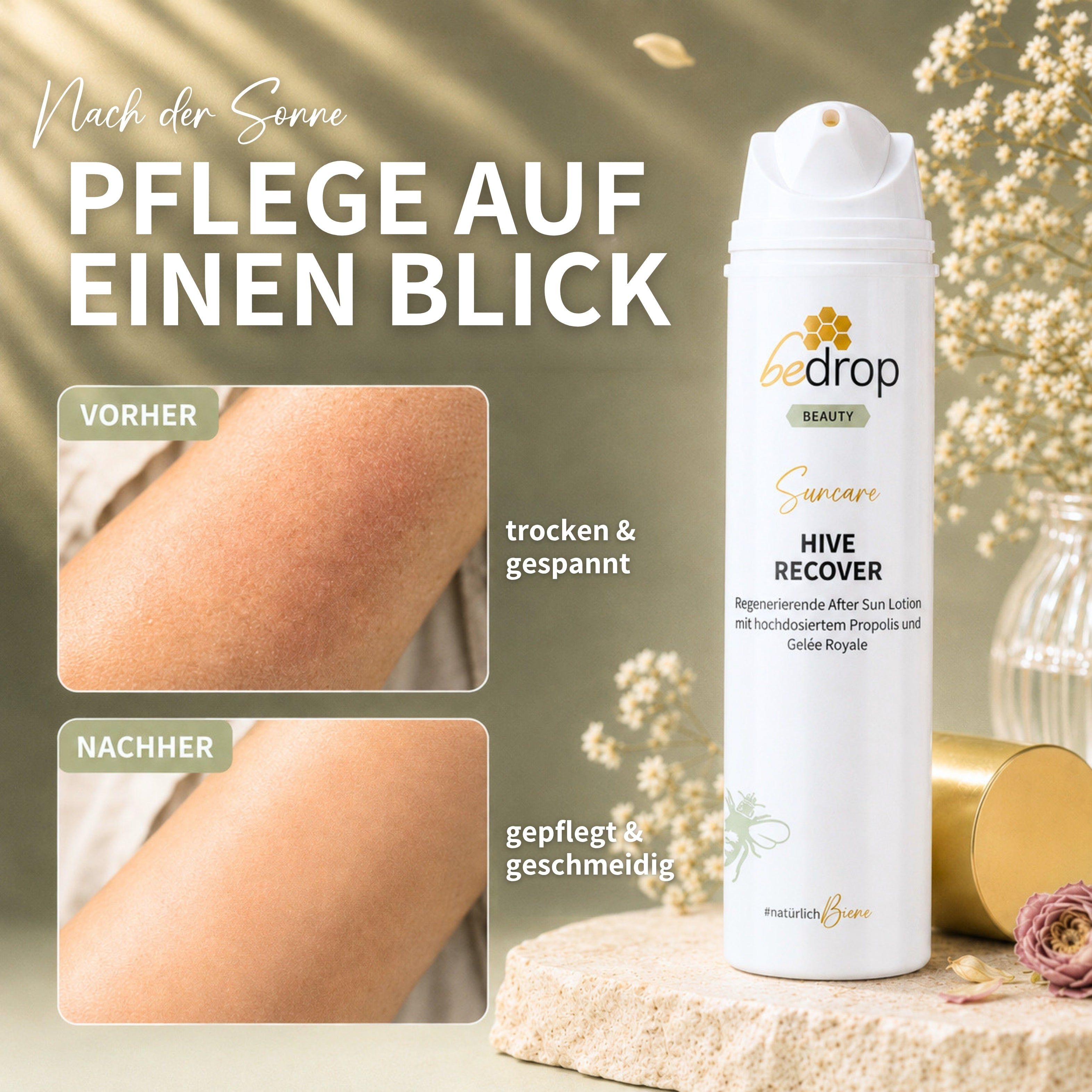 Vorteilsset: 3x HIVE RECOVER - After Sun Lotion mit hochdosiertem Gelée Royale & Propolis