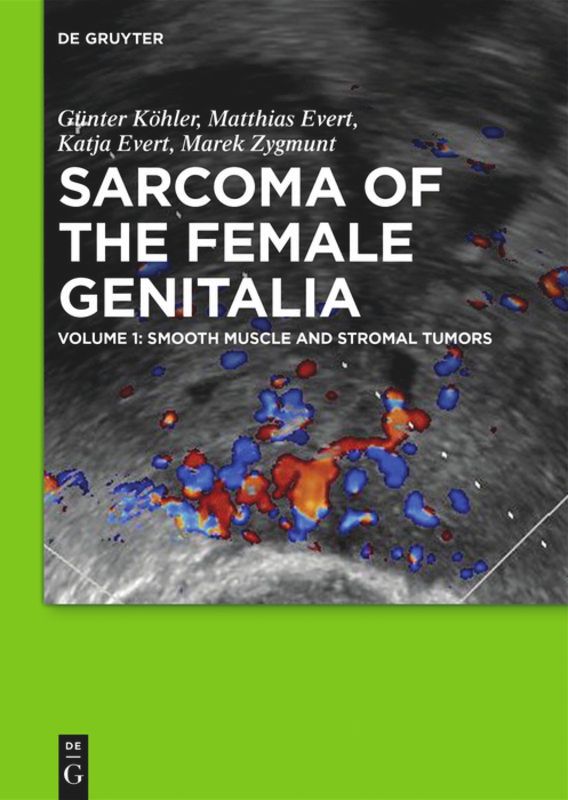 Sarcoma of the Female Genitalia Smooth muscle and stromal tumors and prevention of inadequate