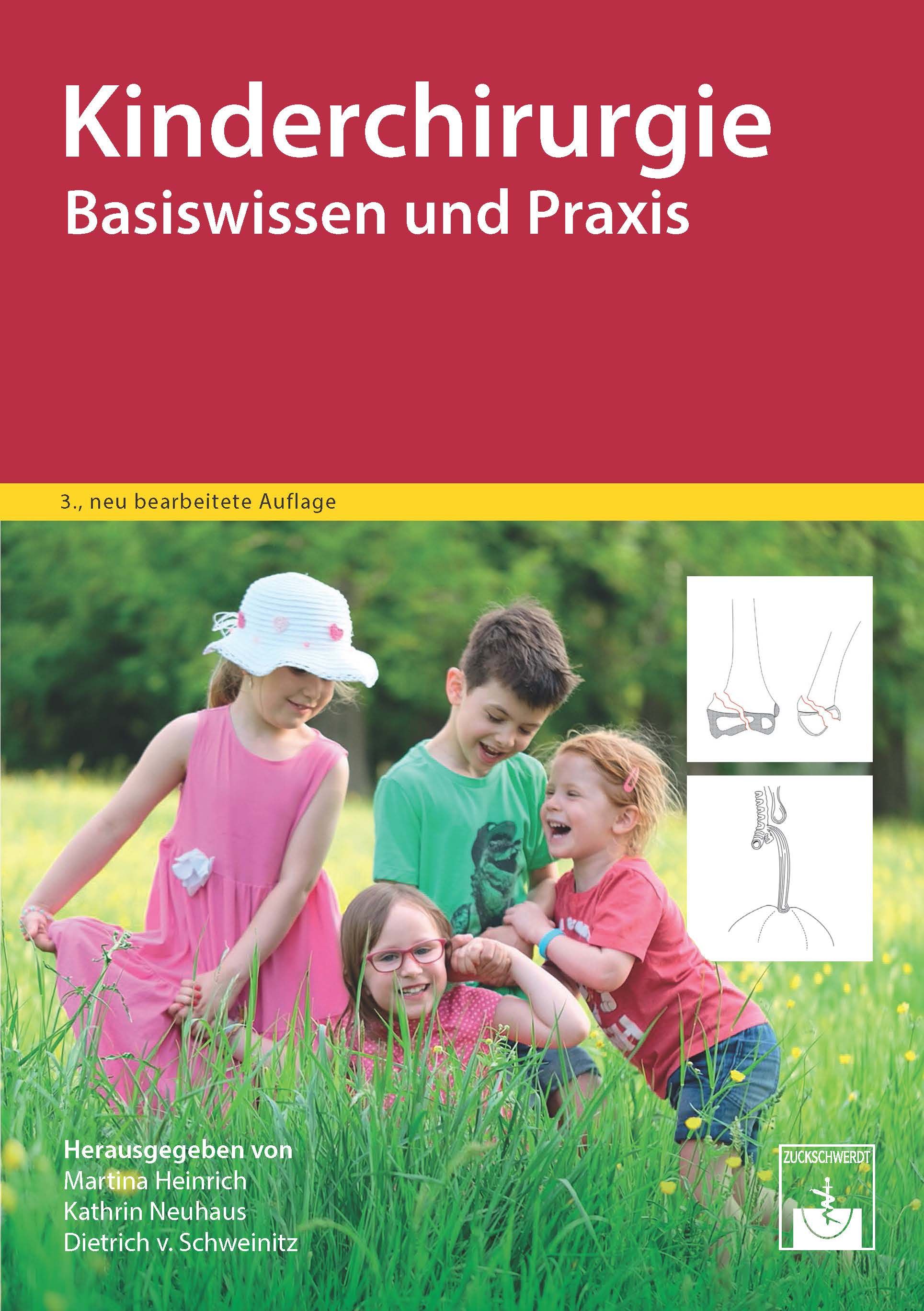 Buchcover: Kinderchirurgie, Basiswissen und Praxis. Auf dem Cover Kinder im Gras. Herausgegeben von Martina Heinrich, Kathrin Neuhaus, Dietrich v. Schweinitz.