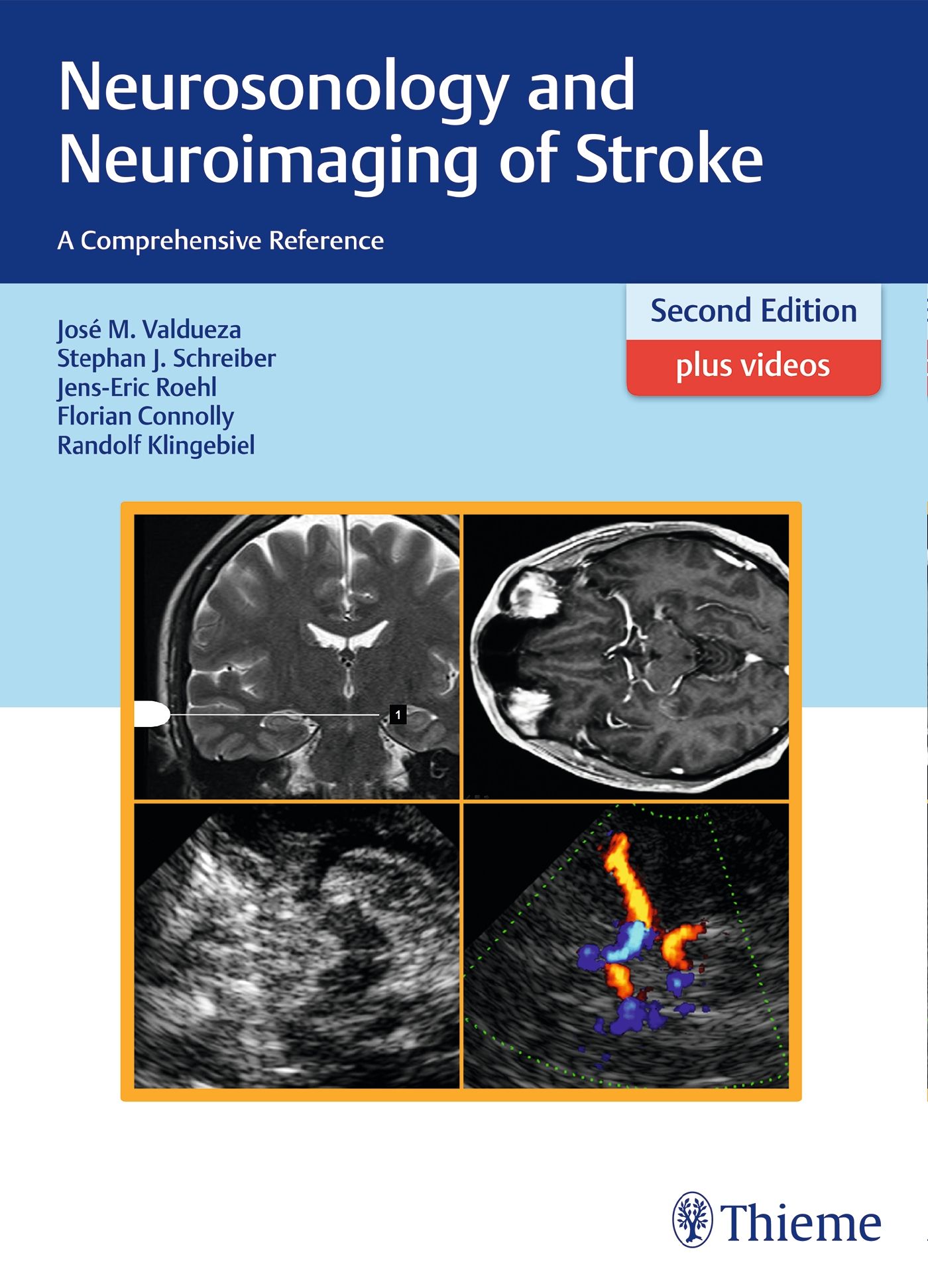 Buchcover: Neurosonologie und Neuroimaging of Stroke. Zweite Auflage mit Videos. Autoren: Valdueza, Schreiber, Roehl, Connolly, Klingebiel. Verlag Thieme.