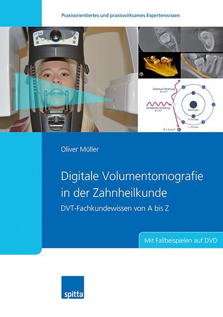 Digitale Volumentomografie in der Zahnheilkunde