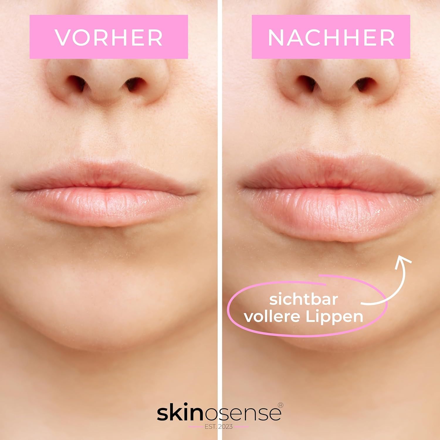 Skinosense® Lip Booster Set, Hydra Derma Roller 3.0 mit 105 Nadeln & Lip Booster Serum