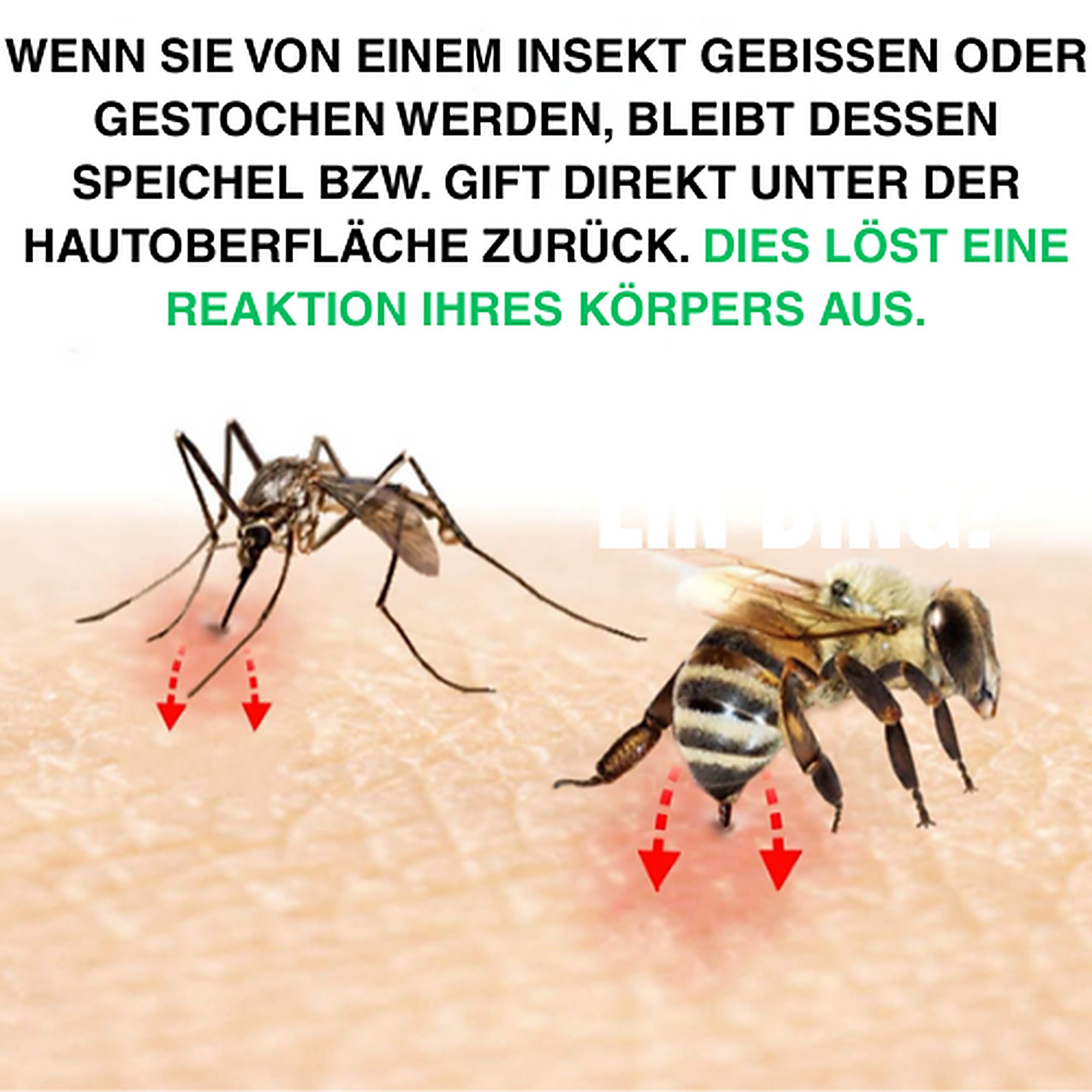 Grafik: Mücke und Biene auf Haut. Rote Pfeile zeigen Reaktionen. Text: Speichel/Gift bleibt unter Haut zurück.