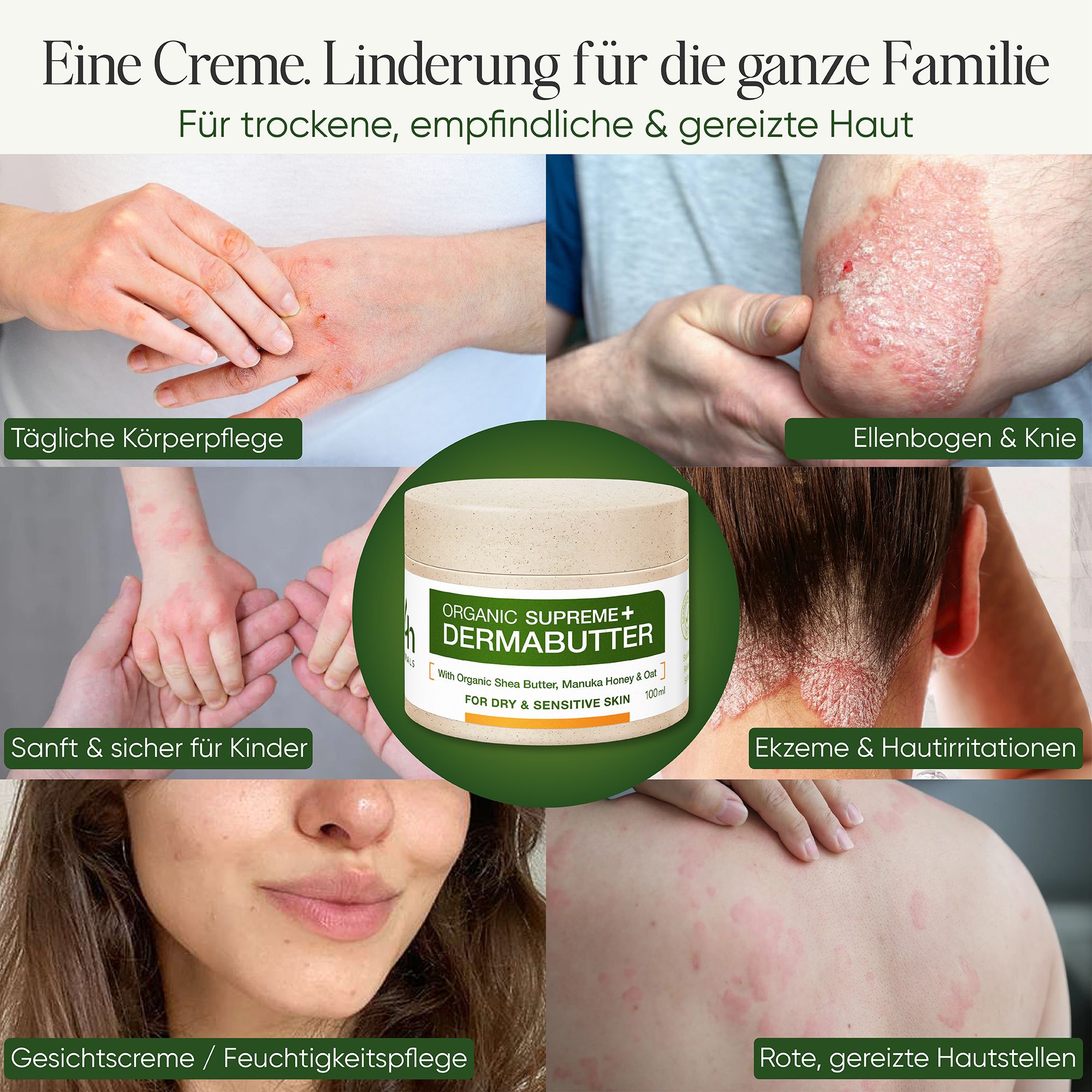 Produktabbildung mit Anwendungsbeispielen. Text: Eine Creme. Linderung für die ganze Familie. Für trockene, empfindliche Haut.